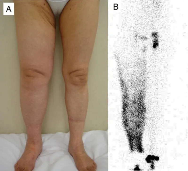 Close view of swollen lower legs